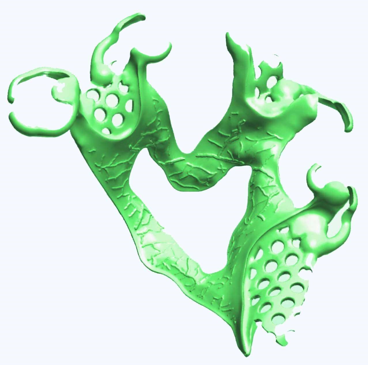 Metallprothese