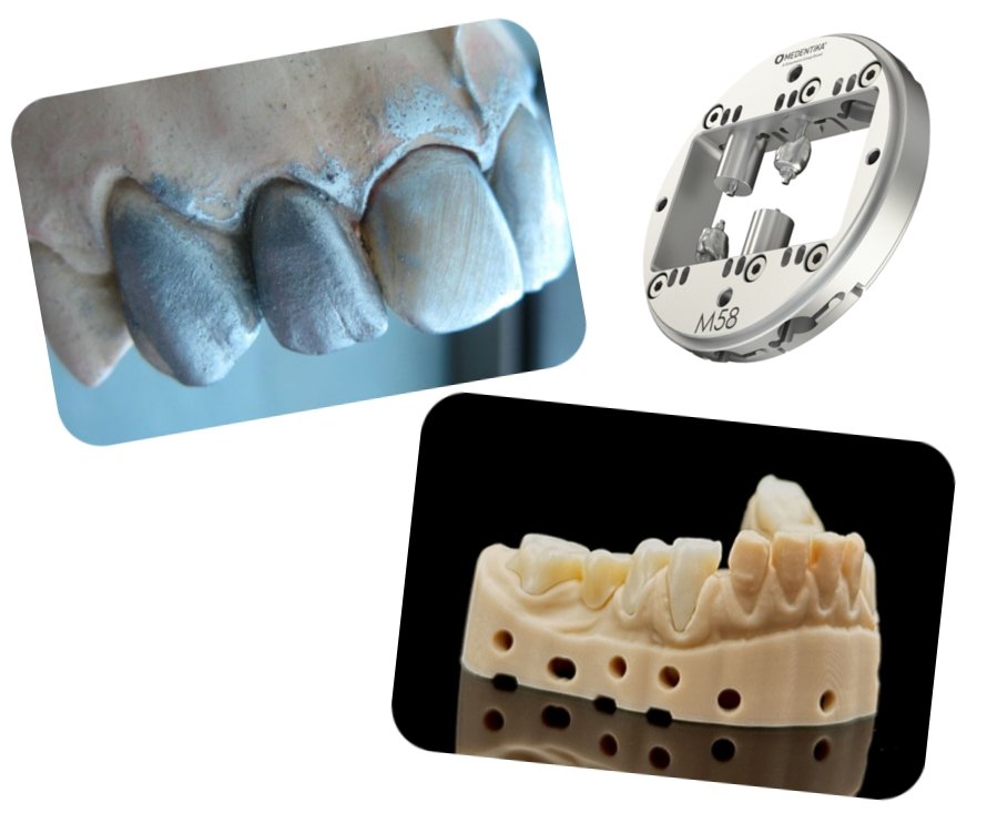 CAD/CAM-Zahntechnik – unbehandelte Oberfläche, industrielles Spannsystem und präzise gefrästes Modell